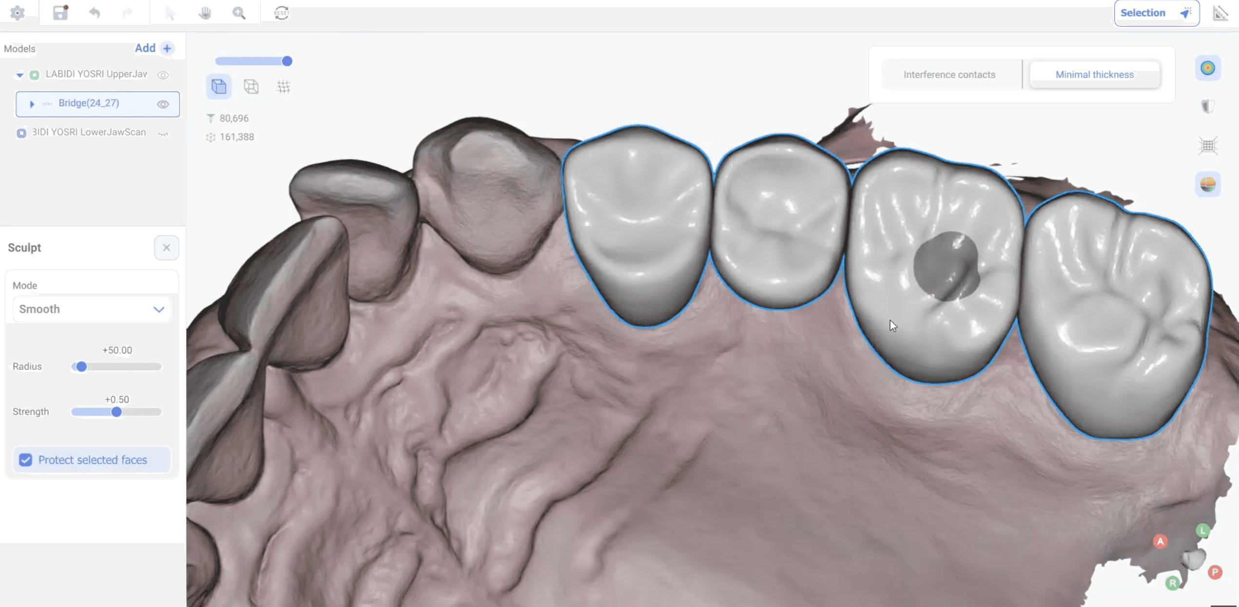 Example restoration design in Atomica AI software